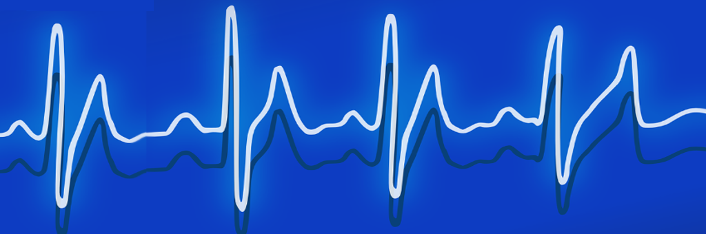Image fréquence cardiaque